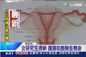 (接舊帶)捐卵險喪命1200