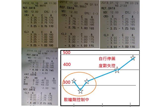 散瞳劑是毒藥？別再聽信網路謠言了！