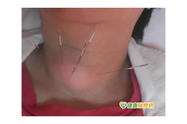 脖子變大怎麼辦？甲狀腺囊腫原因是…