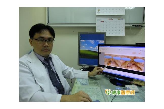 愛日曬、人工助曬成古銅色？小心罹癌