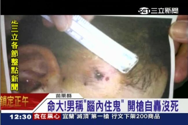 自稱腦袋住鬼　舉槍自轟子彈卡頭沒死