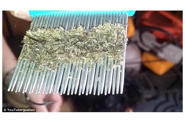 驚悚！母親幫女梳頭　竟梳出百萬頭蝨