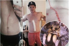 湯瑪斯蜘蛛/翻攝自英國《鏡報》