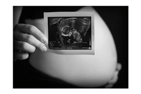 懷孕（flickr_Trevor）