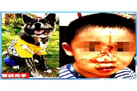 秋田犬咬傷童-蘋果日報