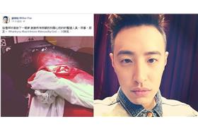 潘瑋柏受傷照／臉書