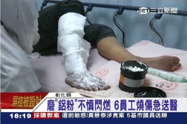 彰化零件廠閃燃意外　6員工燙傷送醫