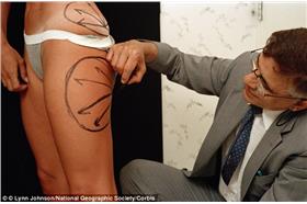 整型/翻攝自英國《每日郵報》