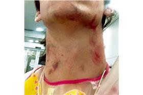 史添頓Matt Stainton/翻攝自國《都市報》