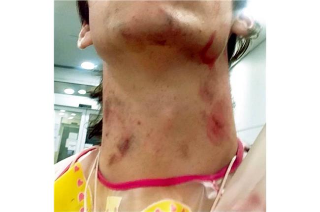 男大生風靡夜店全場　被種50顆草莓