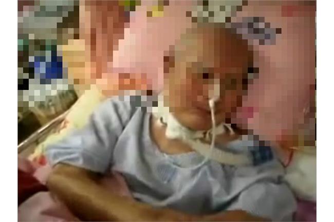 為了18%退休俸　子女不讓老父拔管