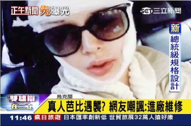 真人芭比自爆被揍　遭疑「掩飾整形」