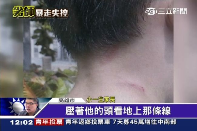 男童掃地掃不好　女老師失控抓傷脖子