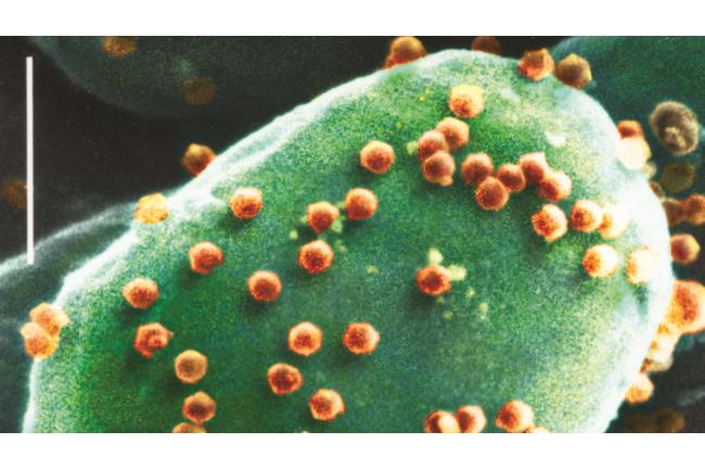 人類變笨竟是因為「病毒」入侵大腦！