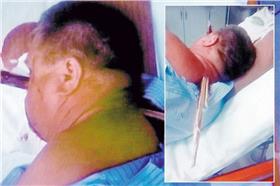 木條穿頸/英國《鏡報》