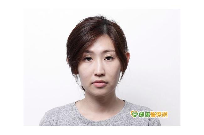 女生注意！皮膚老化怎麼辦？醫師說…