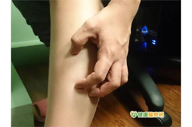 皮膚癢別亂抓！異位性皮膚炎這樣治療