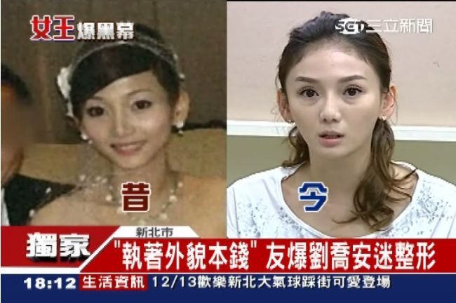 執著外貌本錢　好友爆劉喬安愛整形