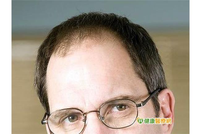 掉髮洗髮精有用嗎？醫師一句話點醒我