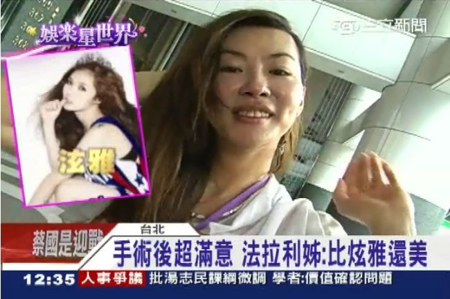 號稱「比炫雅還美」！法拉利姐整全臉