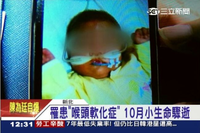 來不及長大　男嬰「喉頭軟化」猝死