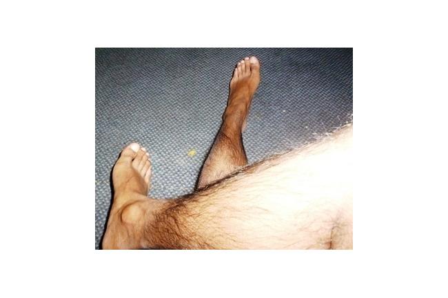 扯！男朋友因為一根腳毛打我