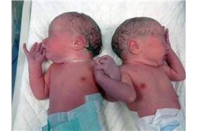 圖／取自Flickr（雙胞胎）