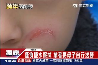 跨年夜驚魂！美麗華煙火燒傷8歲童