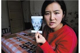 整型失敗　圖／翻攝自《網易新聞》