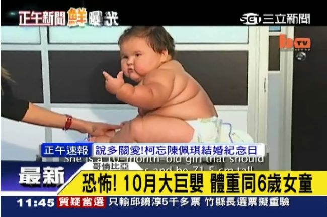10月大巨嬰重20公斤　等同6歲娃