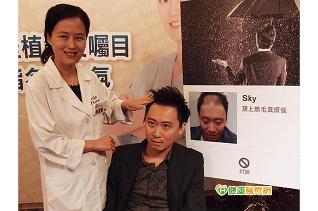 植髮失敗3大原因　這些話不看會後悔