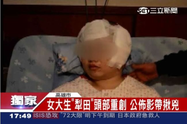 影／大貨車突掉枕木　女大生撞上重傷