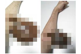 水蛭吸血(首圖用)