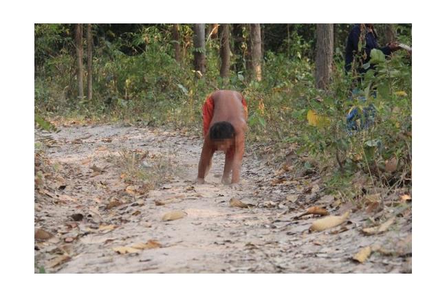 真實案例！泰15歲男孩驚變「狗人」