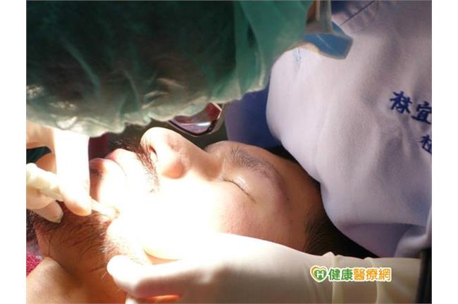 增加「男人味」　植鬍前先注意這三點
