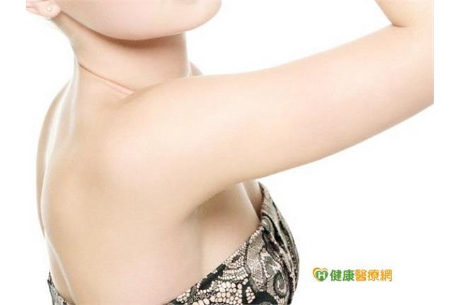 如何改善手臂脂肪、蝴蝶袖？2種方法