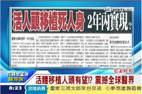 全身體移植手術/資料畫面