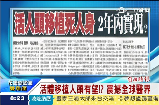 活體移植人頭有望　2年內將成真？