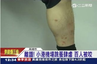 雙腳變紅豆冰！小港機場爆跳蚤咬百人