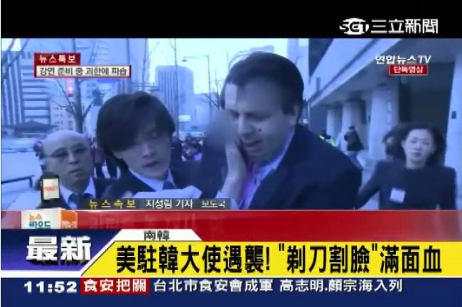 美駐韓大使遭割臉　行兇男曾襲日大使