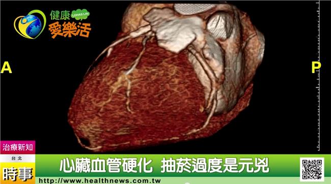 他爬樓梯差點喘不過氣，檢查結果驚人
