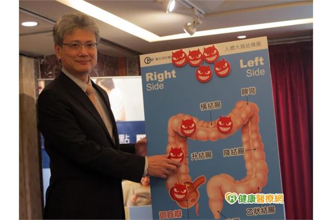 她做了完整大腸鏡檢查　結果竟發現…