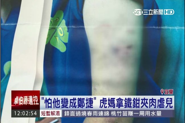 怕他變鄭捷第二！母竟拿鐵鉗夾肉虐子