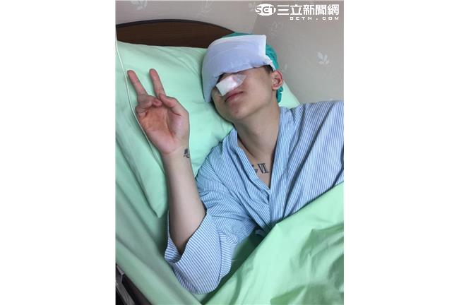 為發片做準備！寶弟開刀治鼻中隔彎曲