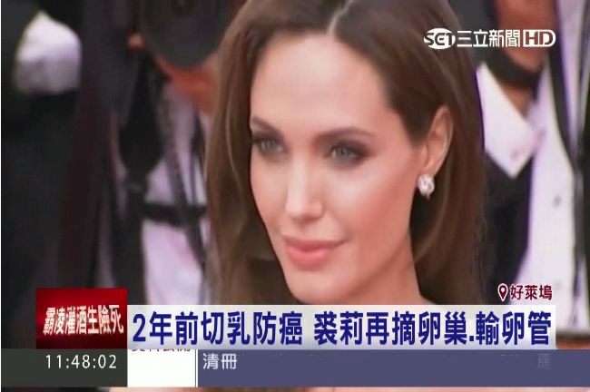 裘莉割卵巢防癌　更年期提早十年出現