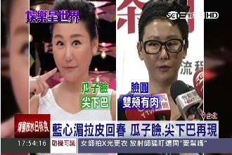 藍心湄拉皮回春　瓜子臉、尖下巴再現