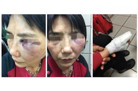 嬤嬤火車上遭毆打/周小豬(家屬)臉書
