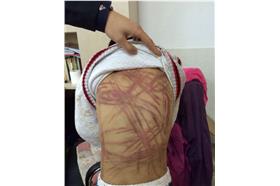 虐童（微博＿朝廷半日闲
http://www.weibo.com/u/1053659804#_rnd1428286448306