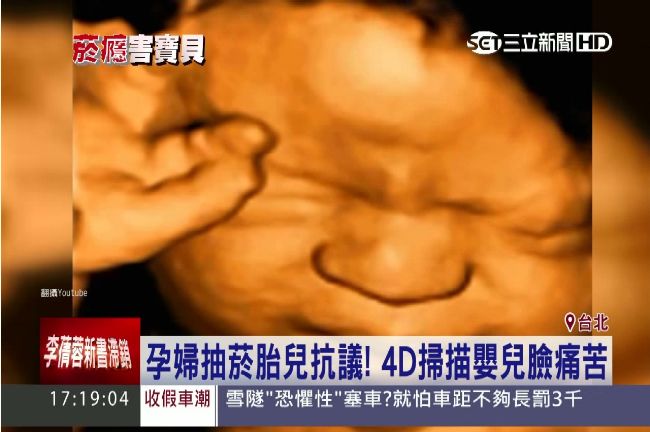 孕婦抽菸　竟照出嬰兒表情超痛苦