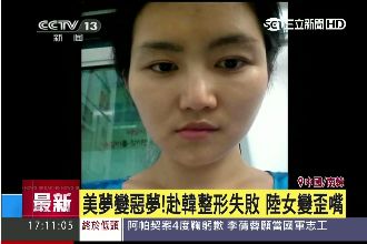 赴南韓免費整型　陸女手術失敗臉全歪